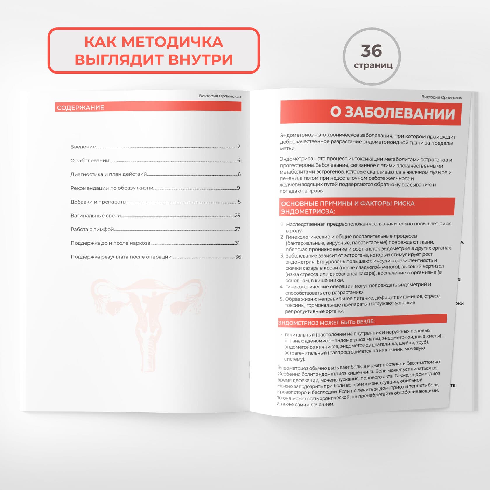 Эндометриоз: инструкция к действию - photo 2